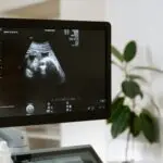 echographie grossesse