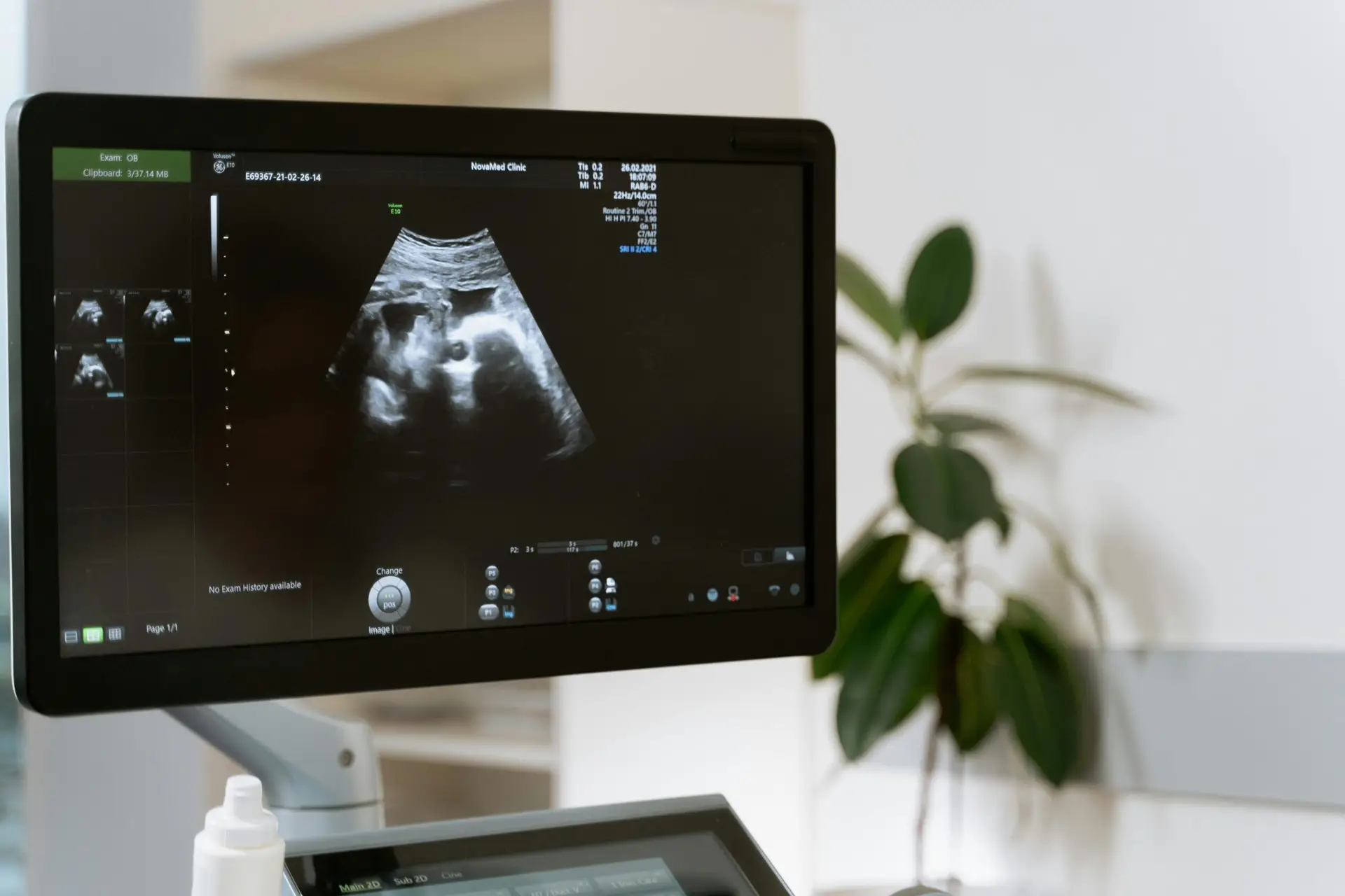 echographie grossesse